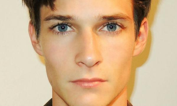 网红达康书记的欧式双眼皮,你真的适合吗?