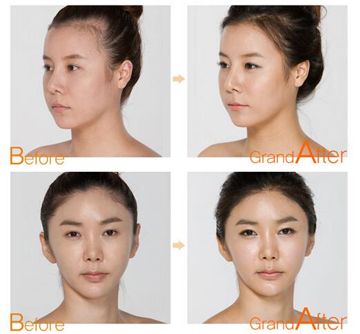 神器在手 亮出宽额头美过韩国妹