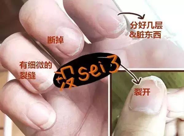 剪指甲时满天飞,居然是不正常的?!