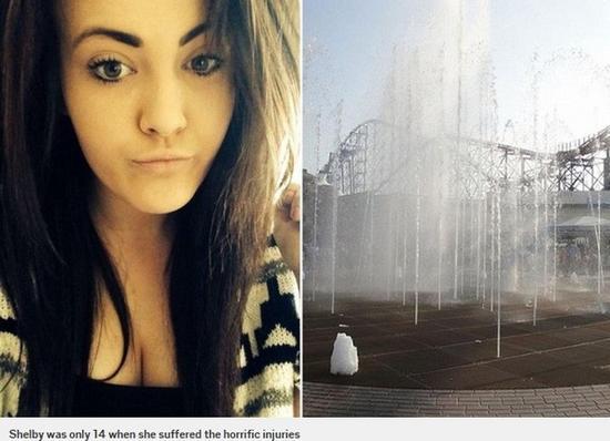 雪蓓14岁时被强力喷泉贯穿下体缝了250针，让她至今仍然无法享受性爱。