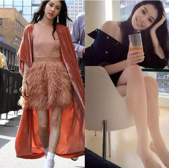 张碧晨敢和奚梦瑶比腿,佩服!但她腿上这些疤是什么鬼…