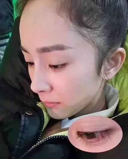 最新双眼皮贴！周冬雨刘诗诗贴得真好看。