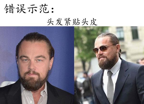 大<em>脑门</em>男生该留什么发型?_时尚_腾讯网