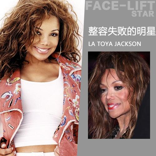 明星真实案例告诉你 整容失败什么样