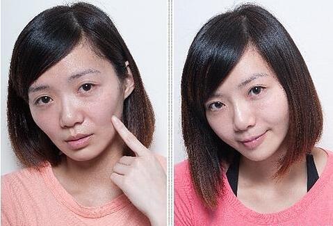 「牙套脸」究竟是心理作用还是真实存在?_时