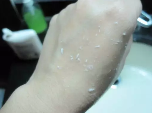 张碧晨敢和奚梦瑶比腿,佩服!但她腿上这些疤是什么鬼…