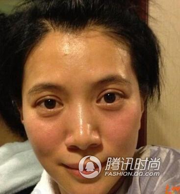 袁咏仪的双眼皮看上去也非常像做出来的,但是她的眉骨高,而且眼窝深
