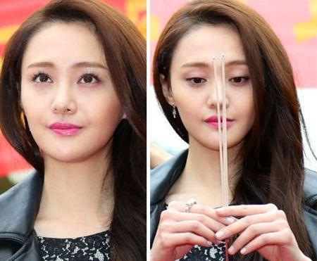 从左至右看看郑爽是如何折腾鼻子的,2014年郑爽因为隆鼻后不满意,在前