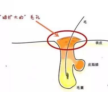 停止傷害你們的毛孔！毛孔粗大其實(shí)還有救!