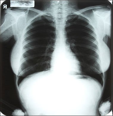 玛丽莲梦露X光胸片将被拍卖 轮廓清晰望卖高价