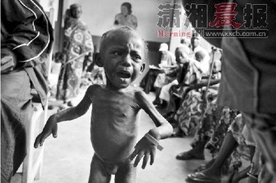 2009年7月底,一个因营养不良而骨瘦如柴的非洲儿童.图/cfp