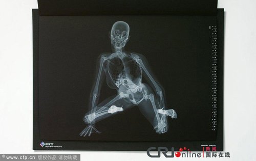 日本一厂商推出X光版骨感美女日历(组图)_新闻