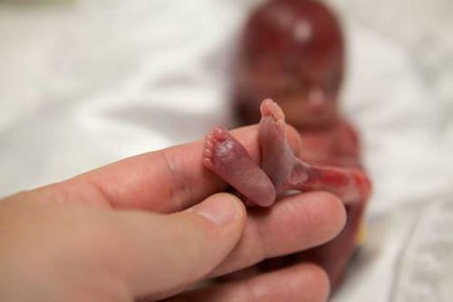 早产儿只有一只手的大小,小脚丫已经完全形成,刚出生时心脏奇迹般的