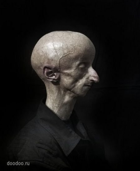 超震撼像外星人的早衰儿组图