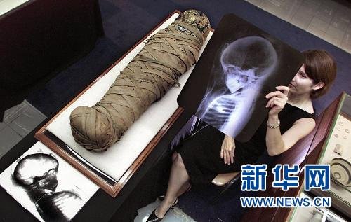 伦琴发现 x 射线