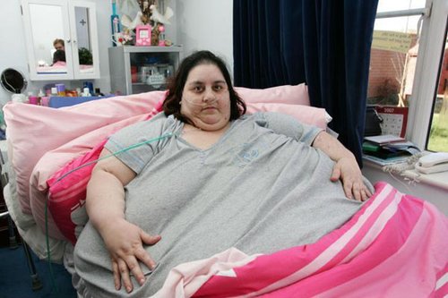 英国最胖女人体重达285公斤 只有几月寿命