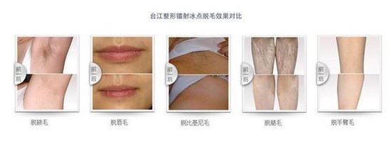 福州台江整形医院做激光脱毛优势_大闽网_腾