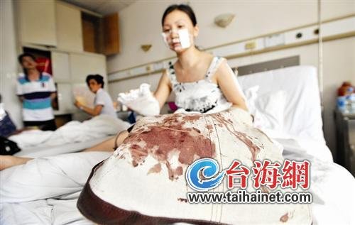 摁倒足浴女遭反抗劫匪残忍从上到下连划数