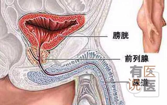福州一男子塞锁头进尿道 原因惊人