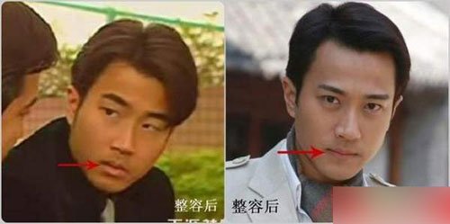 细数tvb被传整容的男明星