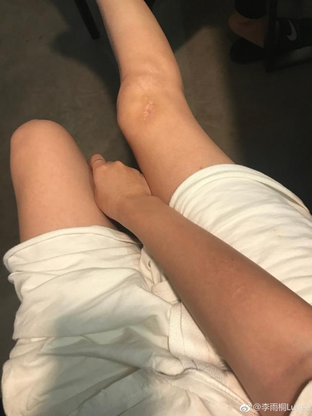 ����ͩ�ص���Ѧ֮ǫ�������࣬������ʵ��������Ѧ֮ǫ����Ҫ����