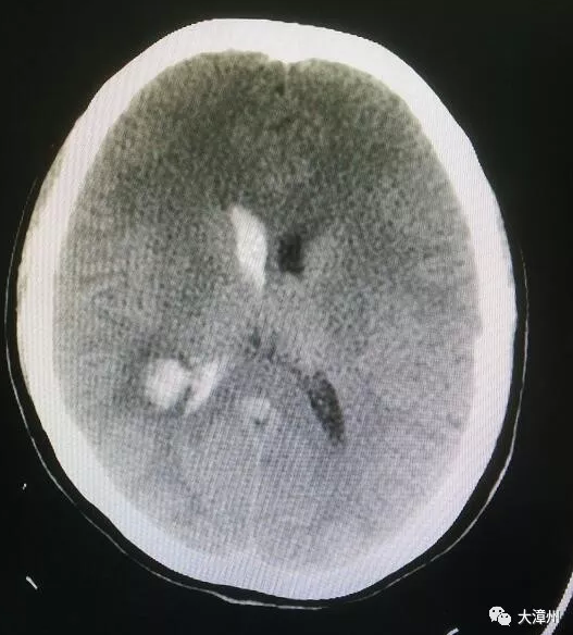 因500元打退堂鼓 多亏医生劝说龙海一女士捡回
