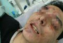 夫妇俩纠集马仔砍杀医学博士