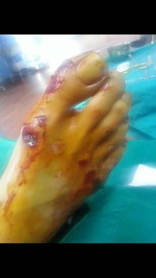 ����ͩ�ص���Ѧ֮ǫ�������࣬������ʵ��������Ѧ֮ǫ����Ҫ����