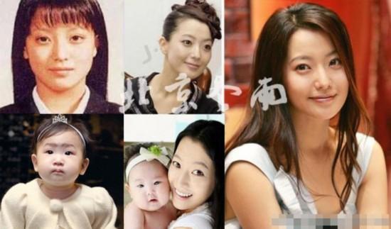 揭韩国明星整容内幕