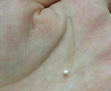 女子吃 生蚝吃出珍珠  概率仅百万分之一_大闽网