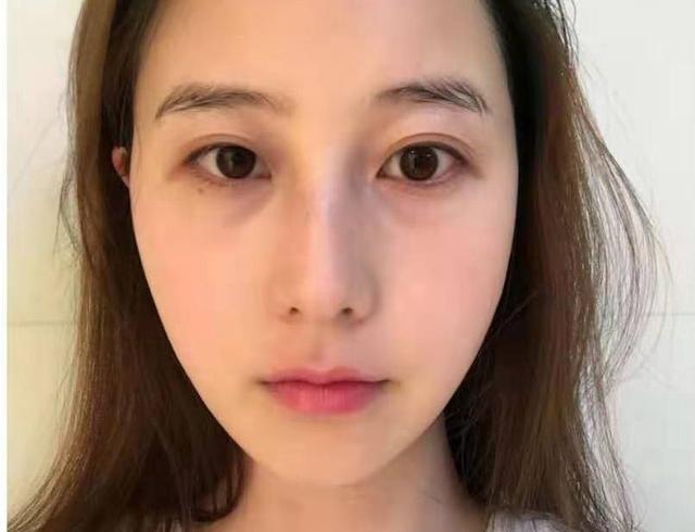 莉琪眼霜去黑眼圈和修复眼袋为什么这么好