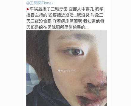 洋葱新闻:最低谷的时光 你是怎么度过的?
