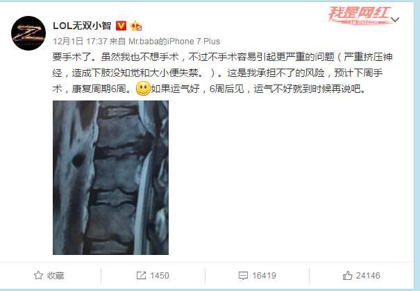 LOL小智养病中复播:150万观众看黑屏刷礼物