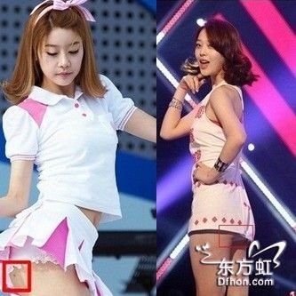 多位<em>韩国女星</em>大腿现黑点疑<em>吸脂</em>所留_大粤