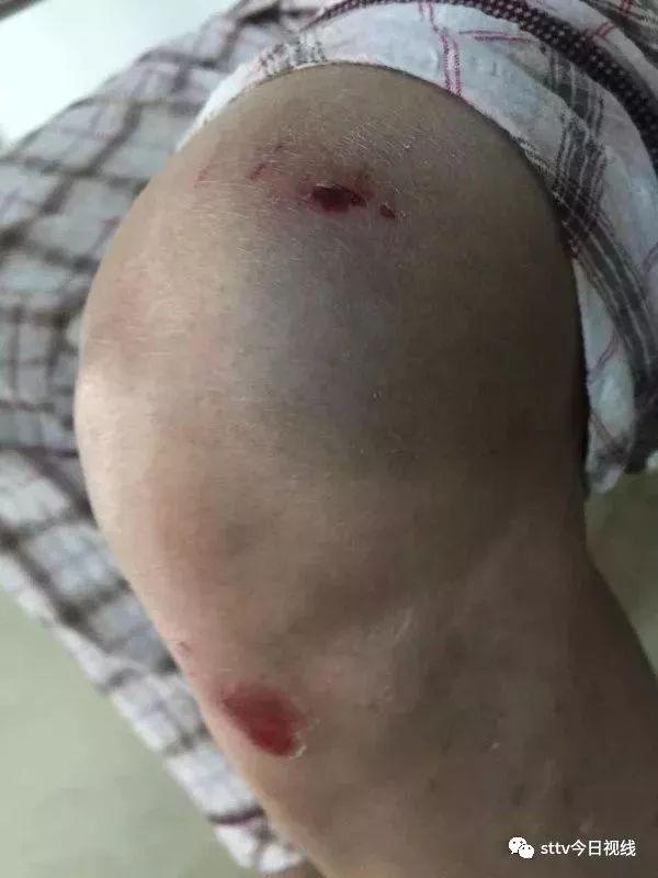 汕頭一別墅區(qū)女子持螺絲刀與睡衣男扭打