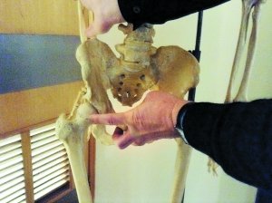 长期酗酒"醉死"股骨头 跟酒量大小无关