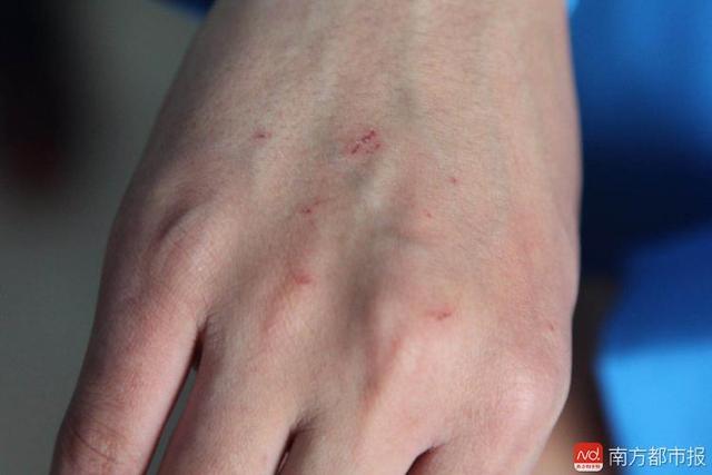 頭部流血！地鐵11號線司機親述驚險過程