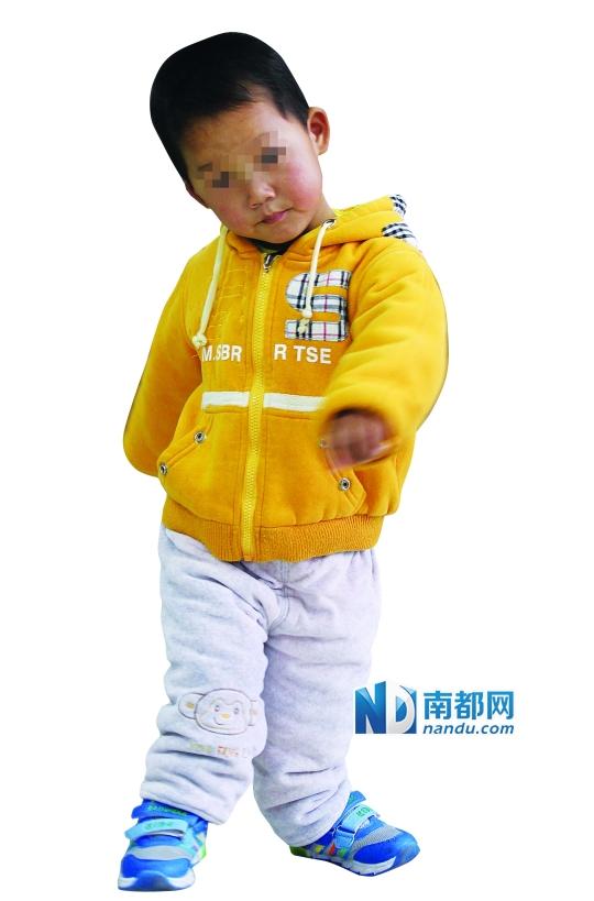 深圳幼童遭父母遗弃机场 孩子双踝关节畸形