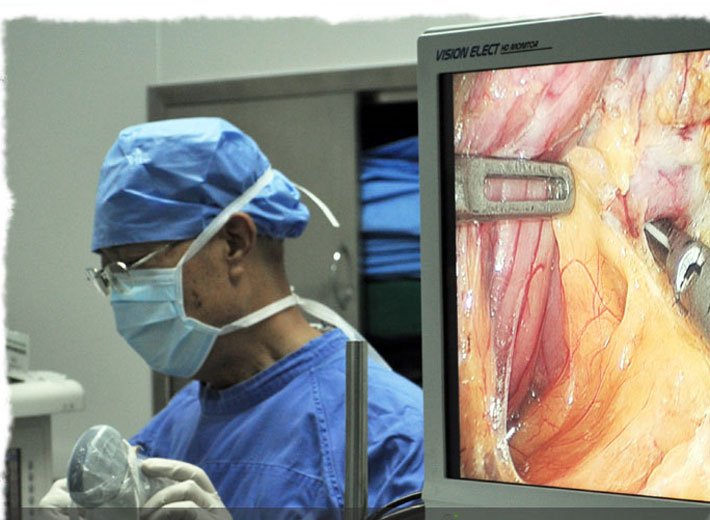 广州华侨医院王存川:腹腔镜胃旁路手术十周年