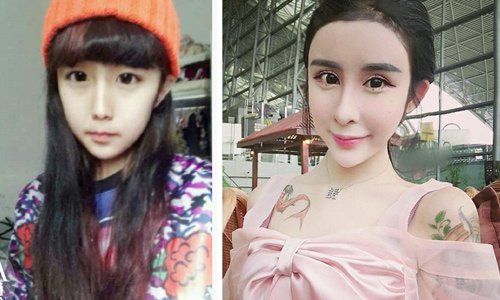 李蒽熙整容前是一个可爱的妹子,整容后却变成了“蛇精女” 李蒽熙整容前是一个可爱的妹子,整容后却变成了“蛇精女”