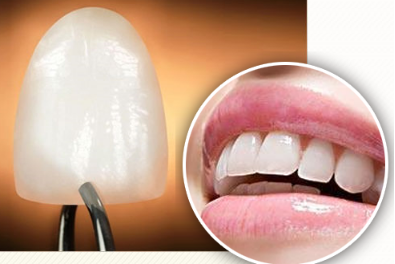 罗朝阳医师:牙贴面修复美白 让美牙变简单