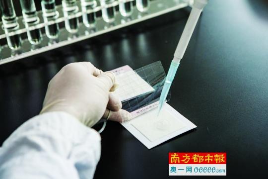 实验证明：筷子暴露3天后沸水冲过还是&ldquo;脏&rdquo;