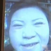 女子注射<em>瘦脸针</em>失败 面部僵硬吃不下饭_大粤网