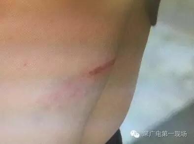 深圳母子频遭家暴 13岁儿子对外人说想拿刀砍父亲
