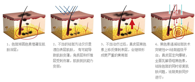公立医院·签约去除脸部色斑 终身负责_大粤Q友会_腾讯·大粤网