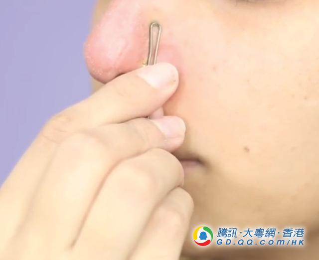 4大去黑头奇法 牙线？牙膏？米饭？发夹？