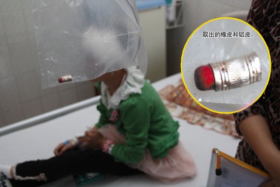 铅笔插进小孩脑内 粗心家长用创可贴(图)_大