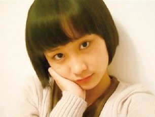 少女拒绝求爱被毁容续:伤情补充鉴定为伤残五级