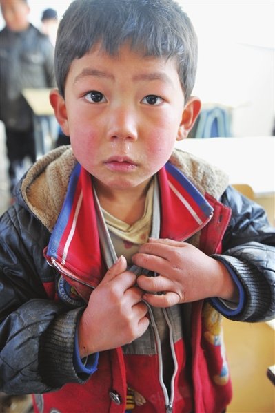宁夏固原干旱山区小学:孩子衣服多从二手市场