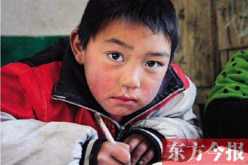杨庄小学的学生,大多家庭条件不好……生冻疮的小手,单薄的旧衣,透风
